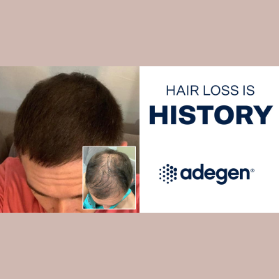 Adegen Coupon Codes & Discounts